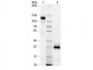 HUMAN IgG F(ab')2